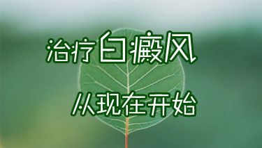 治疗白癜风去成都哪家医院好？如何科学治疗白癜风